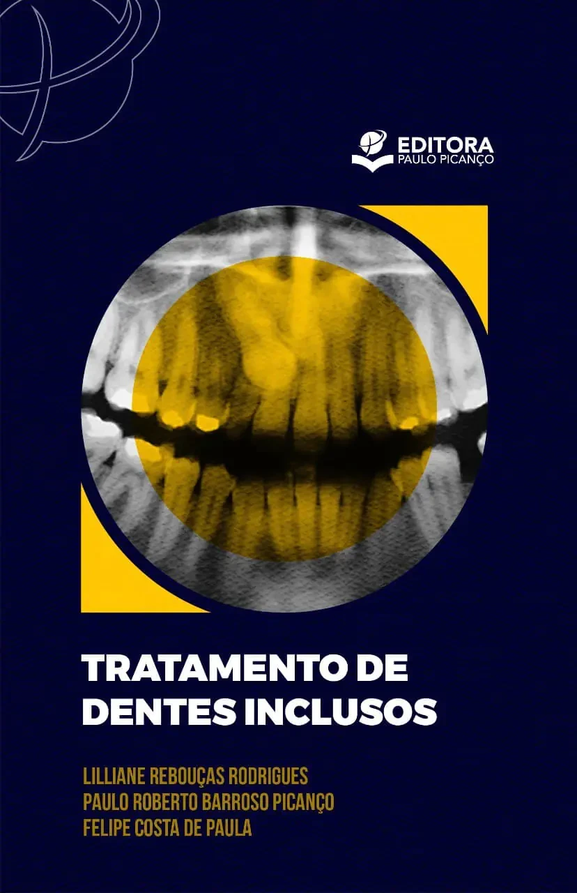 Tratamento de Dentes Inclusos