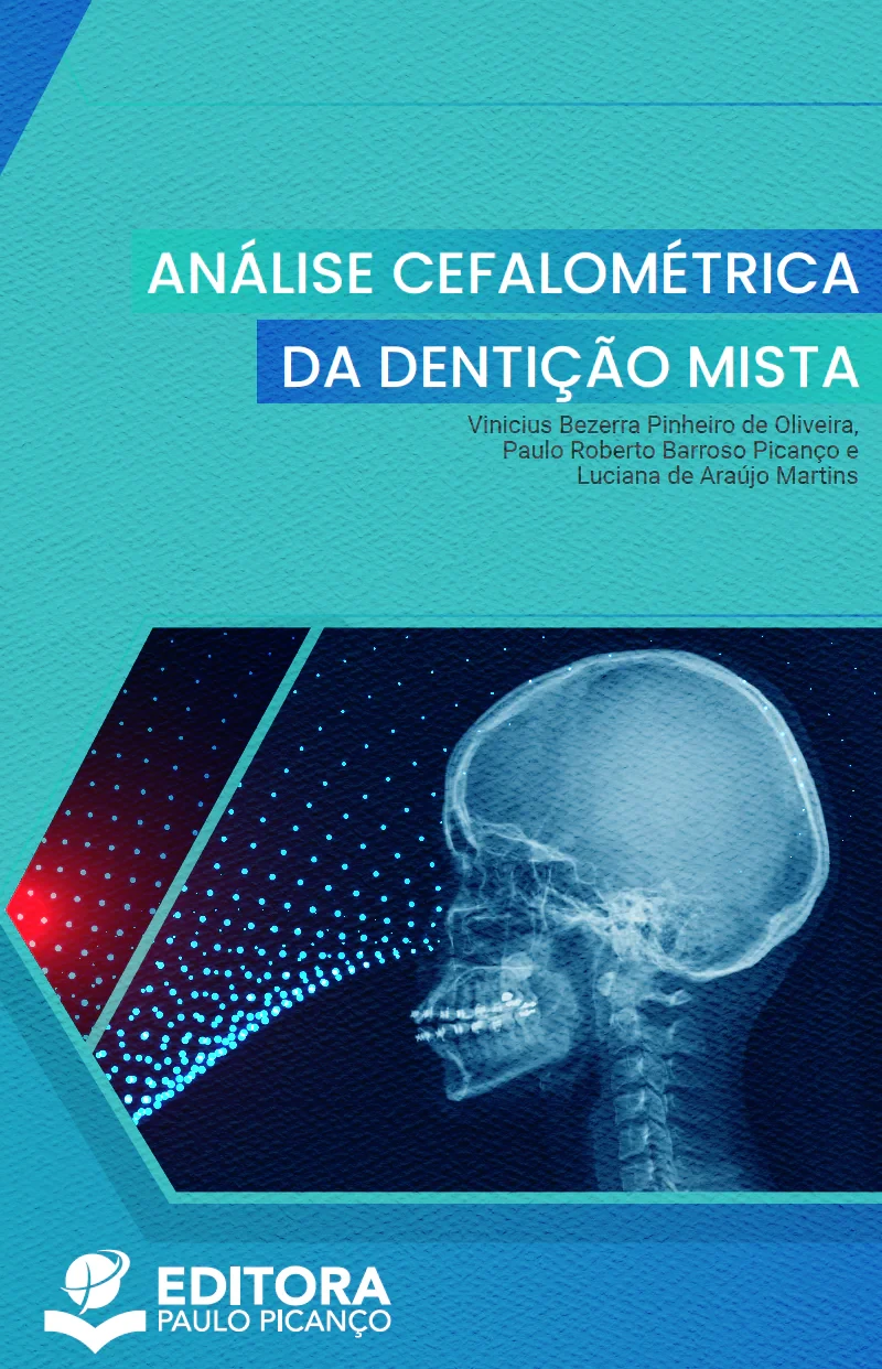 Análise Cefalométrica da Dentição Mista