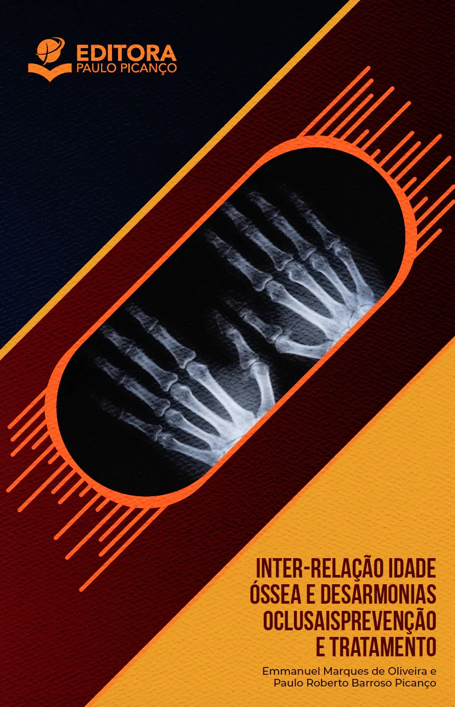Inter-Relação Idade Óssea e Desarmonias Oclusais - Prevenção e Tratamento