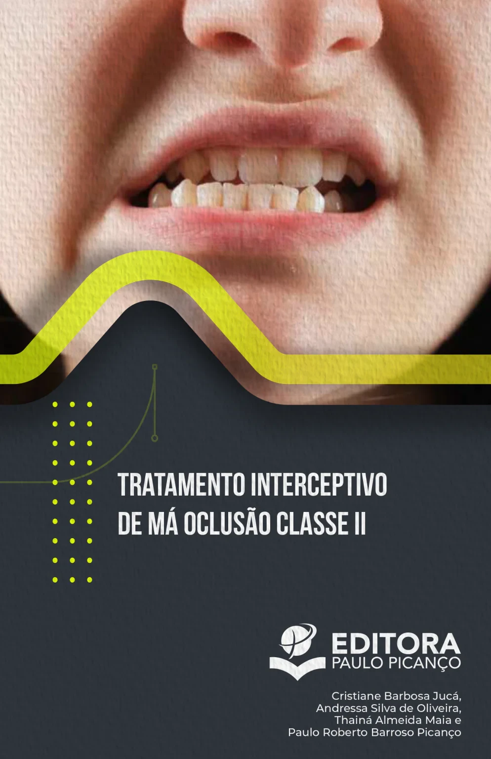 Tratamento Interceptivo de Má Oclusão Classe II