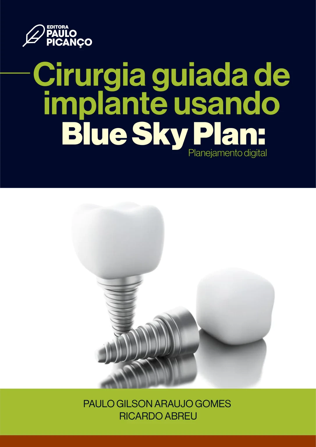 Cirurgia guiada de implante usando Blue Sky Plan: planejamento digital