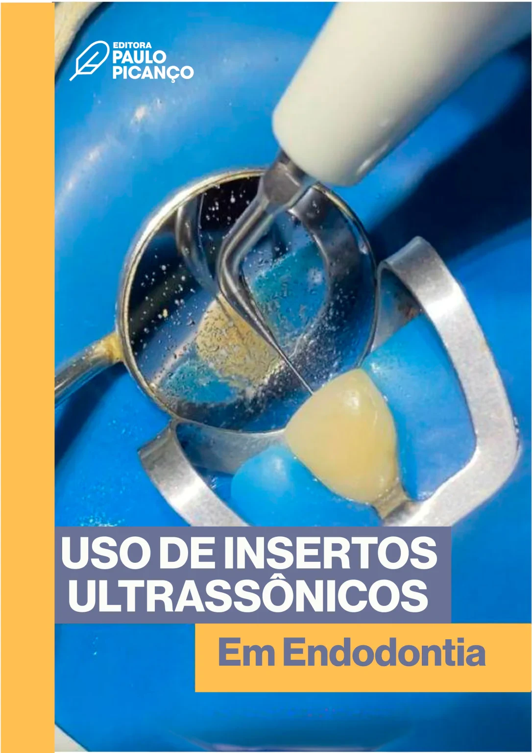 Uso de insertos utrassônicos em Endodontia 