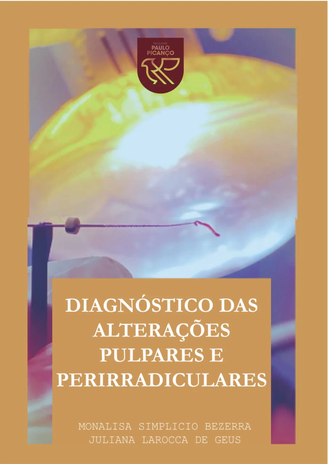 Diagnóstico das alterações pulpares e perirradiculares 