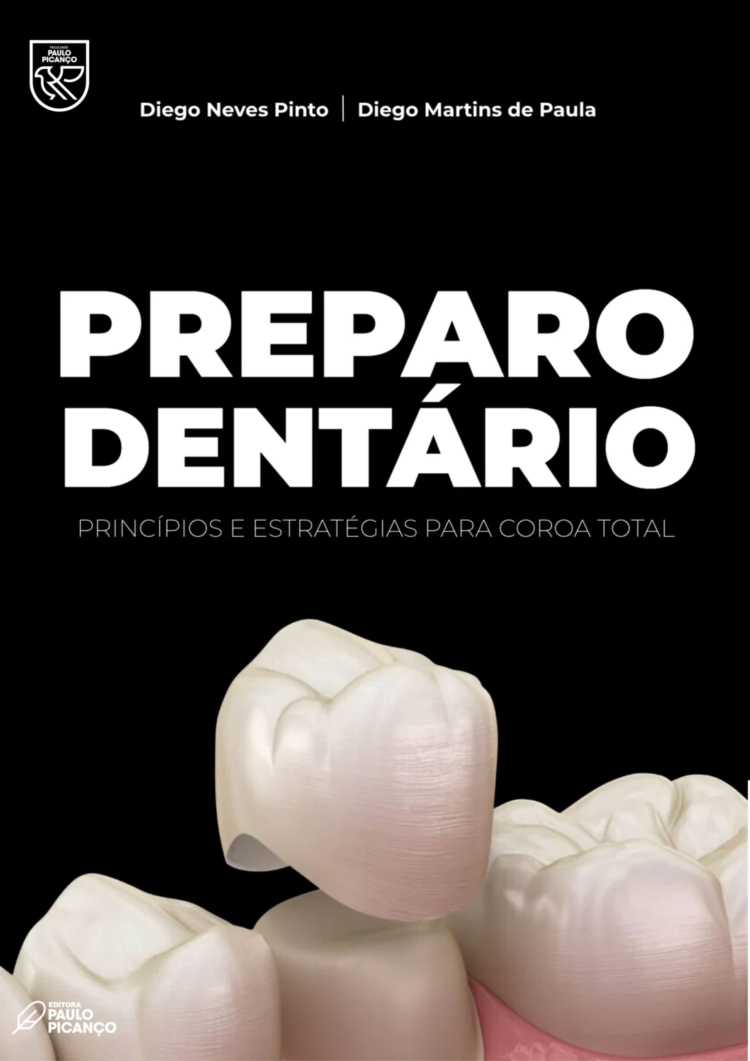 Preparo dentário- principios e estratégias para coroa total 