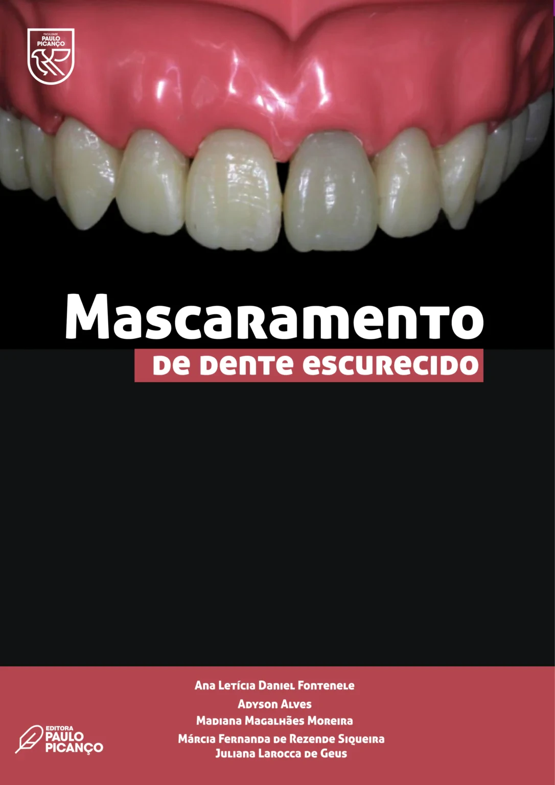 Mascaramento de dente escurecido
