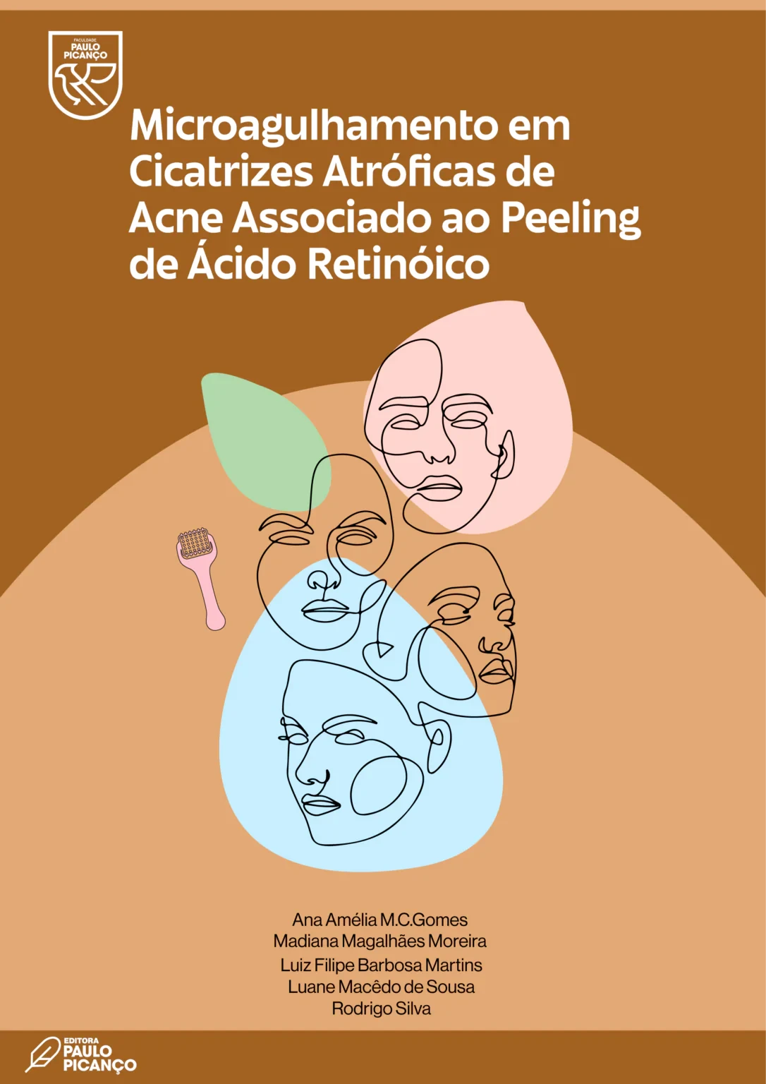 Microagulhamento Em Cicatrizes Atróficas De Acne Associado Ao Pelling De Ácido Retinóico