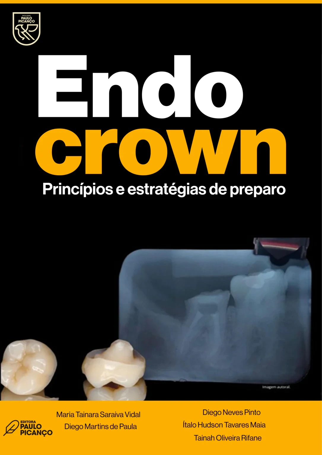 coroa endocrown: princípios e estratégias de preparo dentário para dentes posteriores