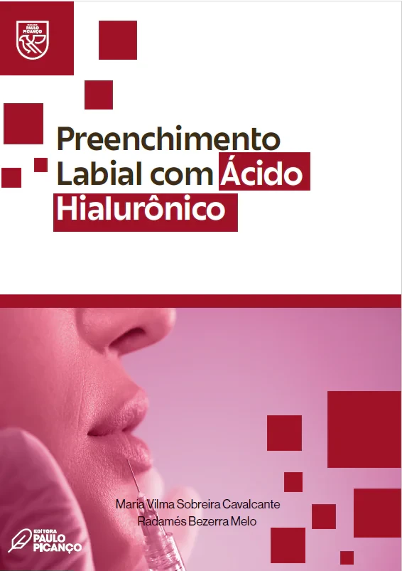 Preenchimento Labial com Ácido Hialurônico 