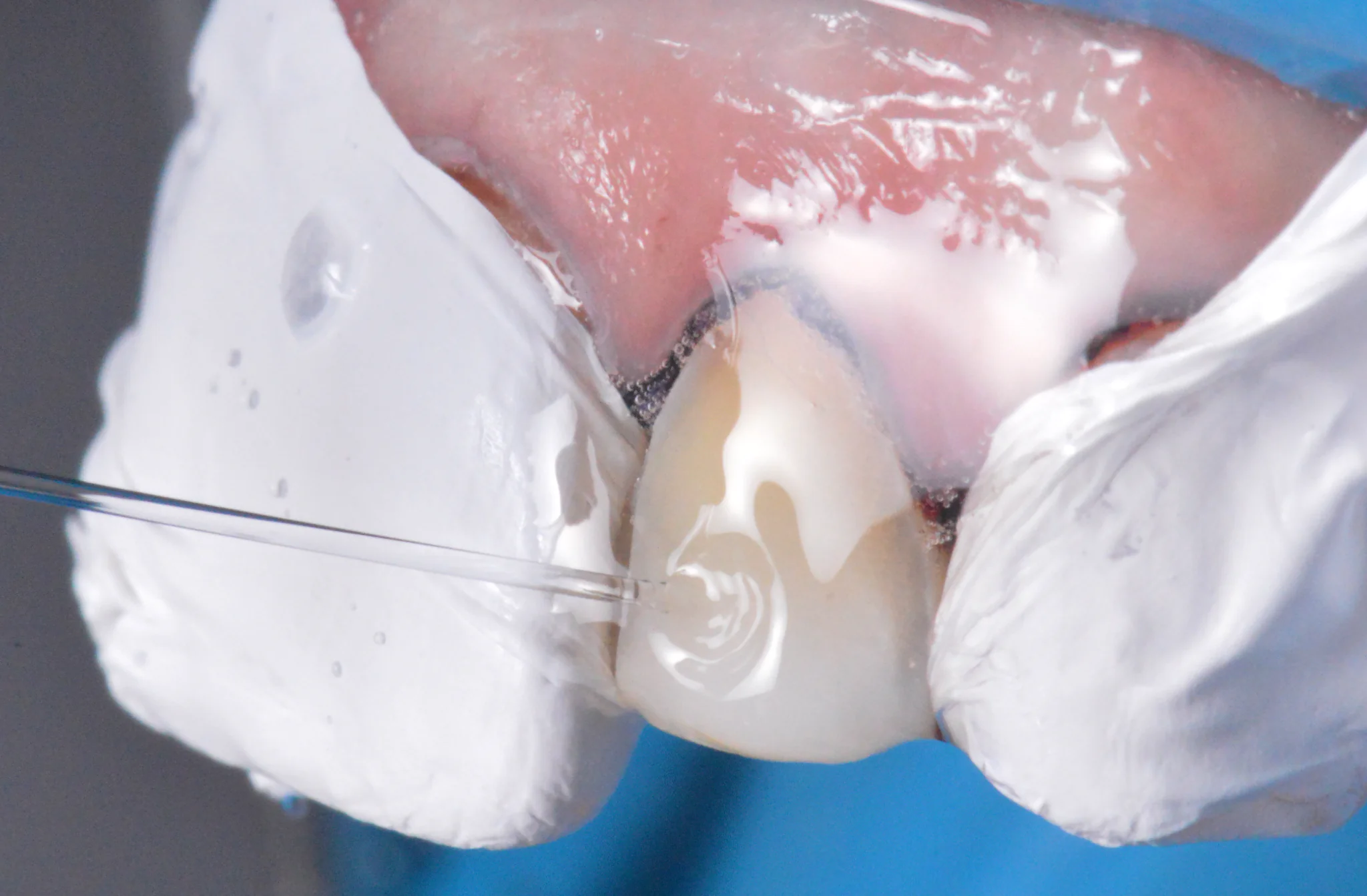 Inscrições Abertas para Imersão em Dentística Estética Restaure